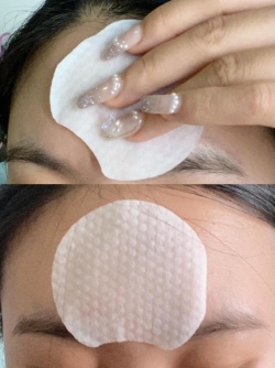 逆天了！施颜适水杨酸棉片， 见证油痘肌的美丽转变