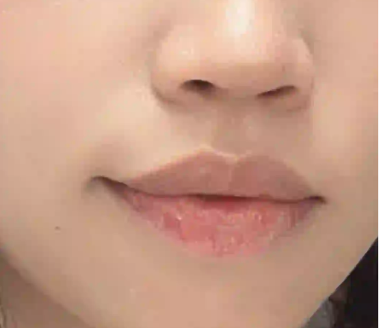 暑假户外疯玩嘴先“破防”？别让忽略防晒的唇拖垮你的出游状态